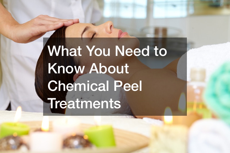 What You Need to Know About Chemical Peel Treatments